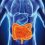 L’intestino influenza la risposta immunitaria